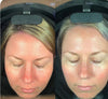 Trudermal Glow LED Light Therapy Face Mask- New Arrival Sale $585 at checkout