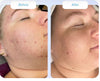 Trudermal Glow LED Light Therapy Face Mask- New Arrival Sale $585 at checkout