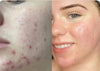 Trudermal Glow LED Light Therapy Face Mask- New Arrival Sale $585 at checkout